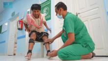 Supported by KSrelief, Prosthetics Center in Yemen’s Hadhramaut Governorate Provides Services to 129 Beneficiaries in June
